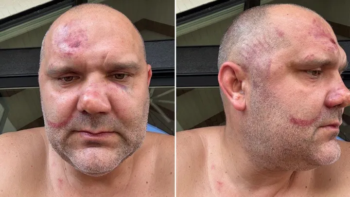 Cincinnati police union rips arrest of White victim in viral street attack as political interference