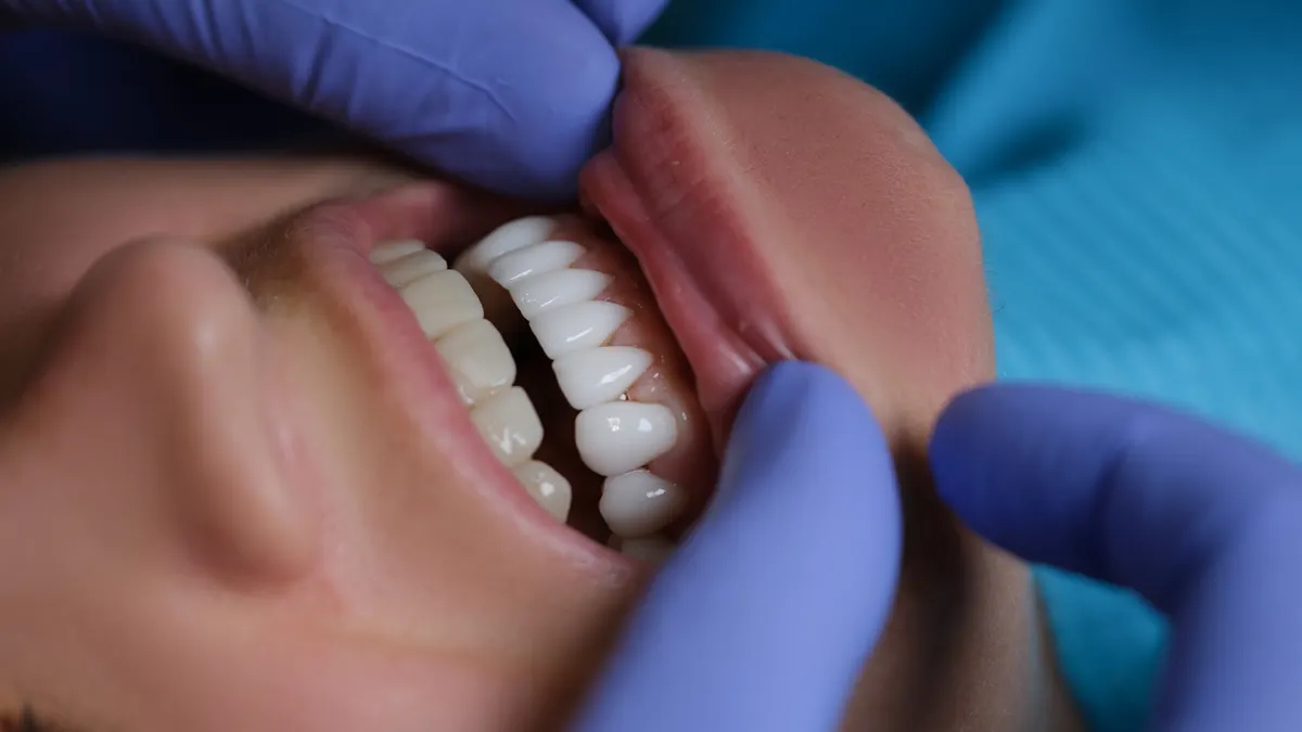 Florida woman arrested for unlicensed dental work allegedly used superglue on victims’ teeth: police